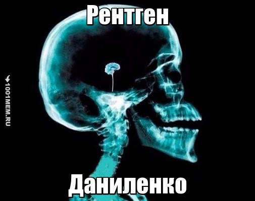 Рентген