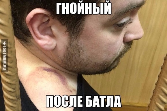 Гной выступил